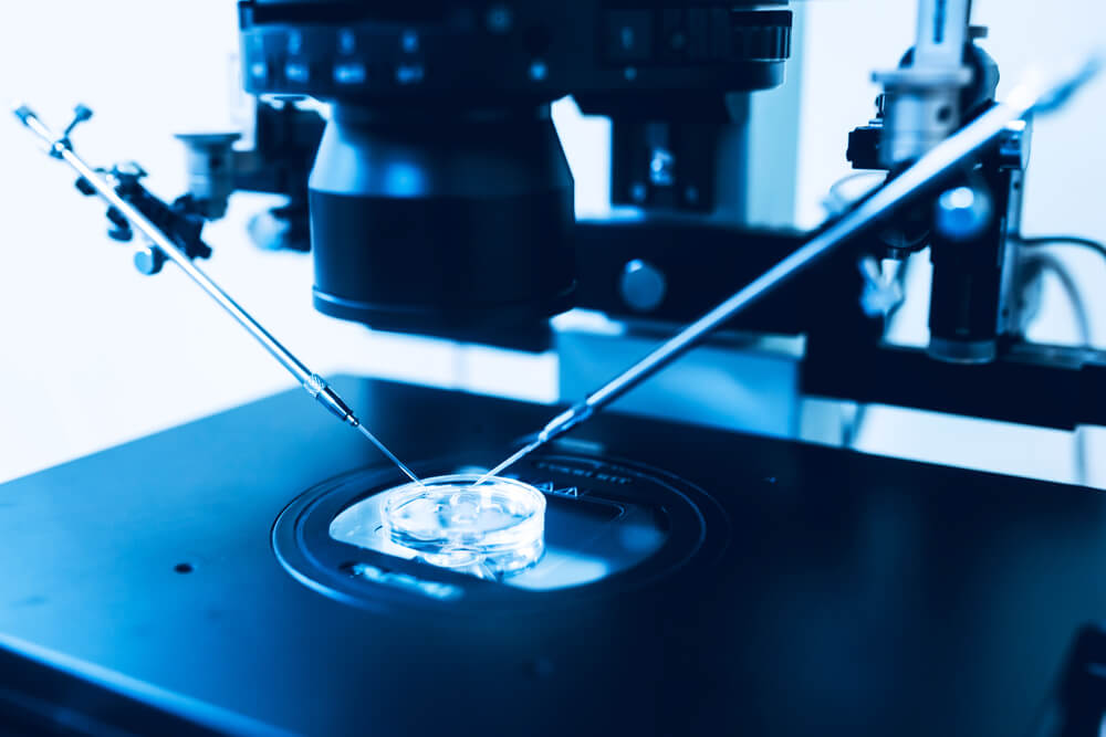Procédure ICSI (Injection Intracytoplasmique de Spermatozoïde) en laboratoire de procréation médicalement assistée, réalisée au microscope avec micromanipulateur pour fécondation in vitro.